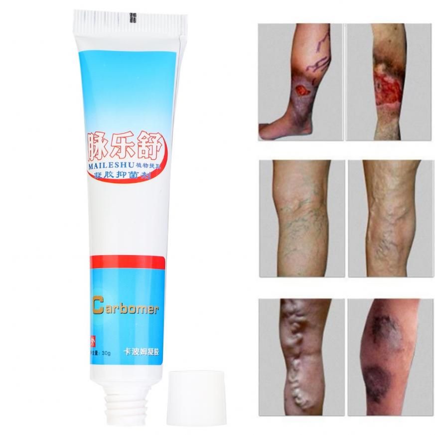 Varicose Vascular Inflammation Massage Cream Treatment Vein Ointment