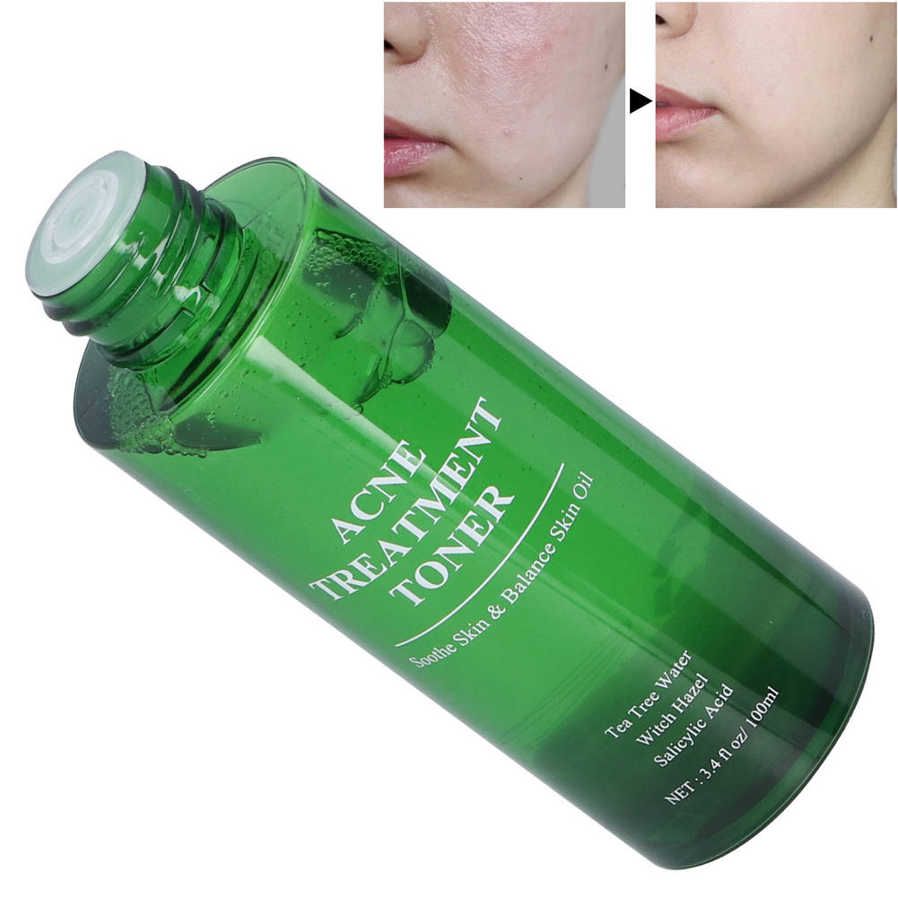 100ml Acne Treatment Toner Pimple Removal Face Skin Cleaning Repairing