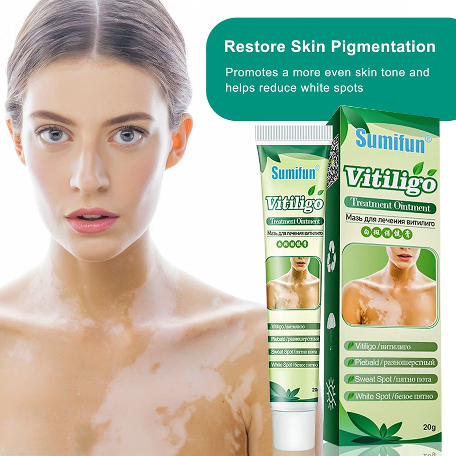 Sumi fun Vitiligo Treatment Healthy White Spot Therapeutic Gel