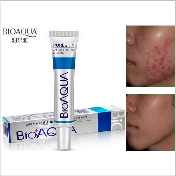 BIOAQUA clean and Acne removal cream- 30g - Face Mask - Face Mask