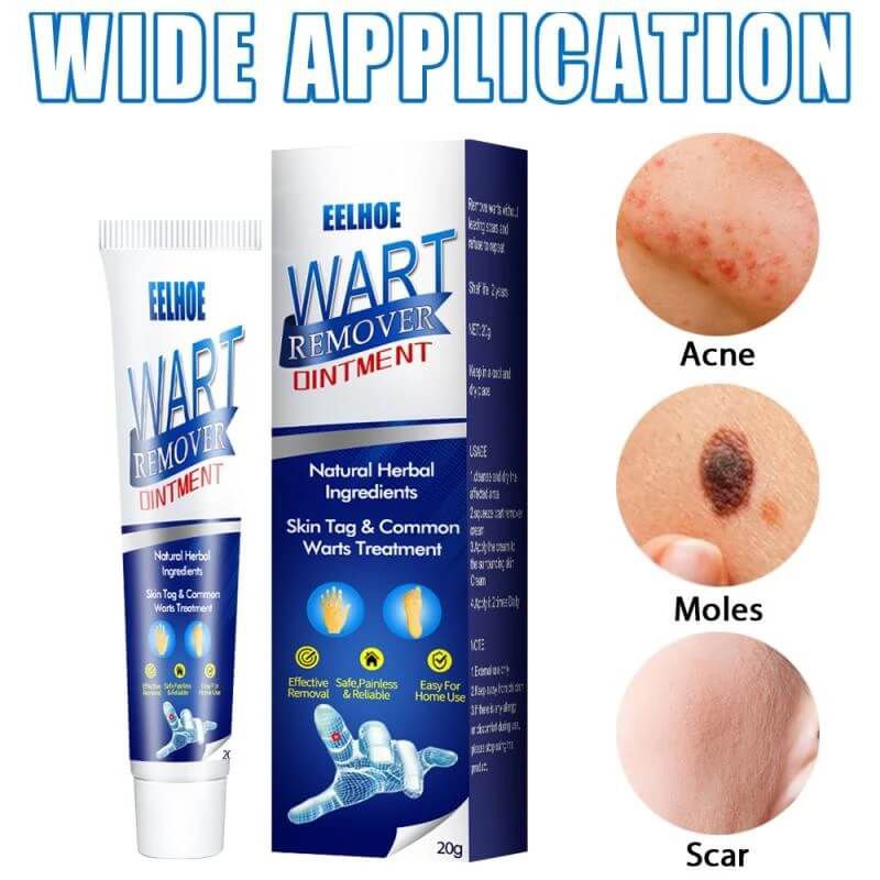 Wart Remover Cream 20g