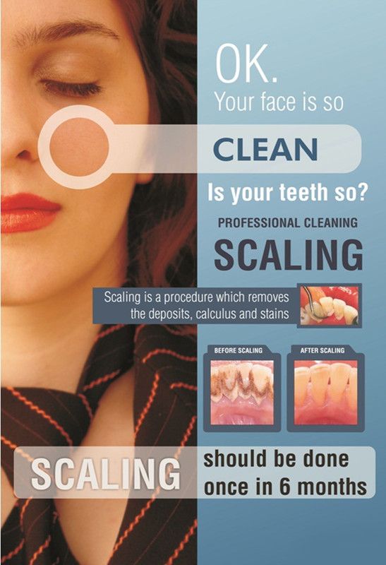 Dental Dentist Poster Wall Poster Print on Art Paper 13x19 Inches Paper Print  (19 inch X 13 inch, Rolled)