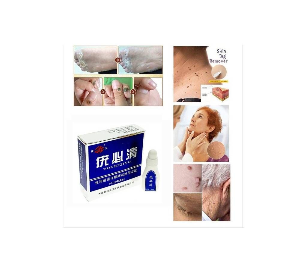 Tag Mole & Genital Wart Remover