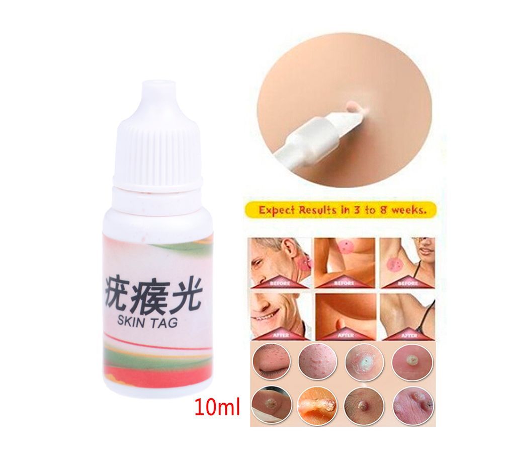 Medical Ointment Skin Warts Removal Chinese Medicine (China)
