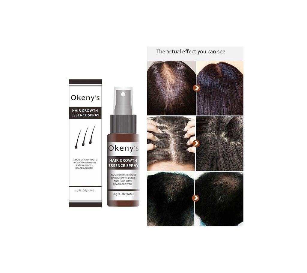 HAIR GROWTH SPRAY FROM CHINA-20ml