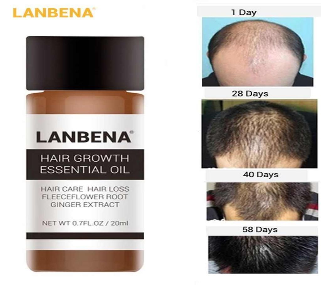 Lanbena Hair Growth Essential Oil