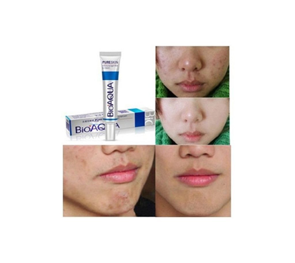 Bioaqua pure Skin Acne Cream  30gm