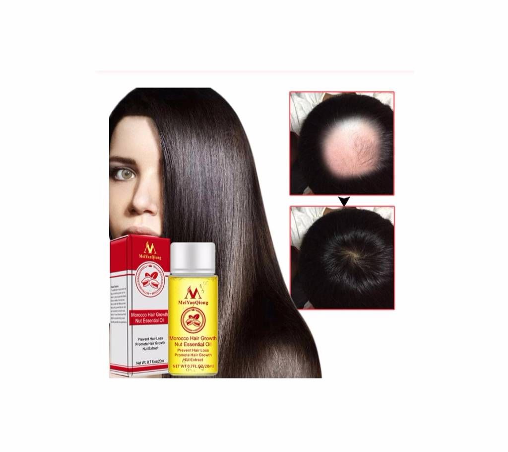 Ginger Oil Faster Grow Hair Stop Hair Loss Treatment