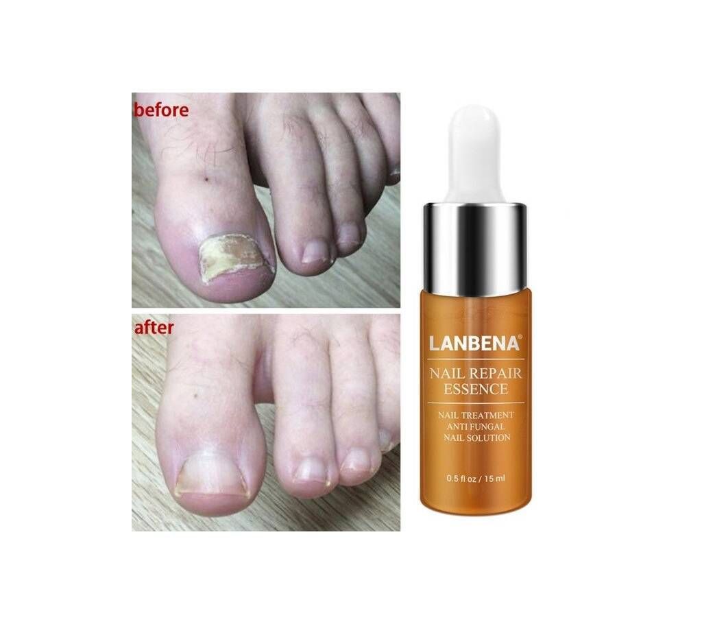 LANBENA nail repair essence 15ml - China 