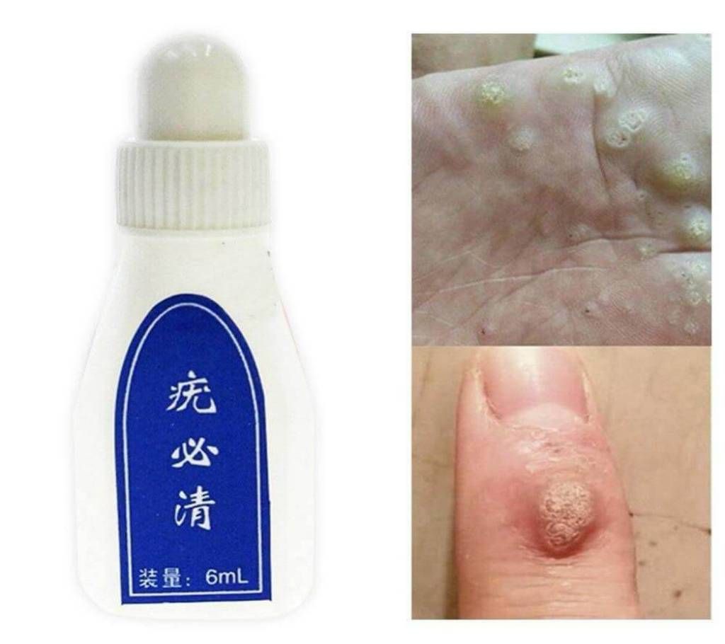 Skin Tag Remover