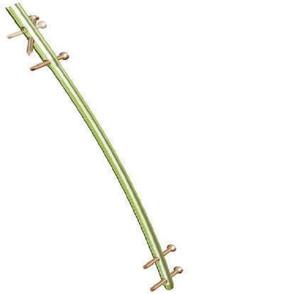 Reconstruction Femoral Nails