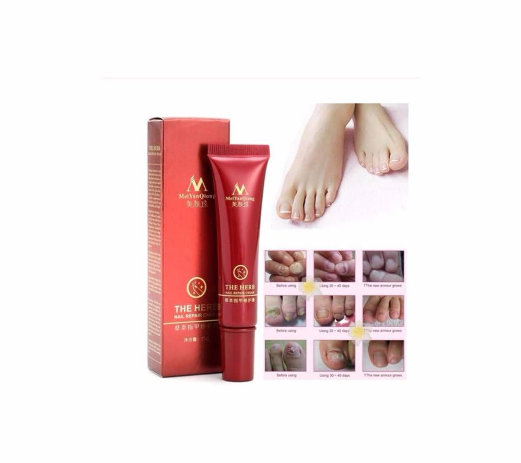 Herbal Nail Fungus Treatment Toe Onychomycosis Paronychia Anti Fungal Nail