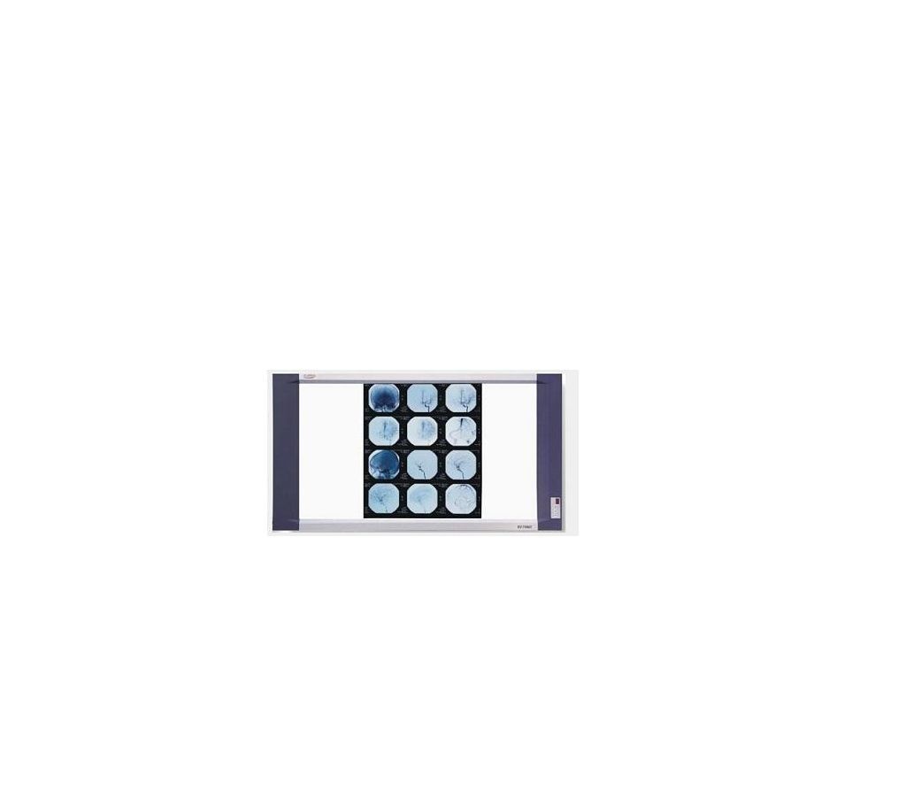 LED X-Ray View Box (Double-Section)