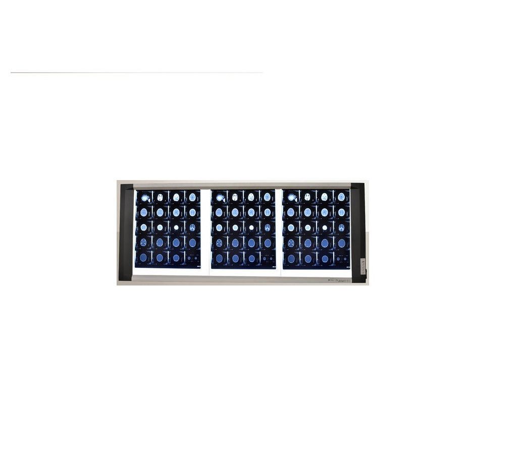 LED X-Ray View Box (Tri-Section)