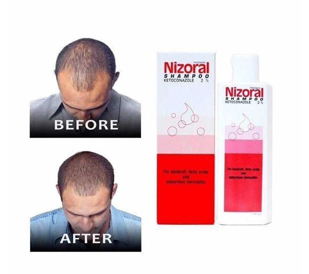 Nizoral Anti Dandruff Shampoo - 50ml - Thailand