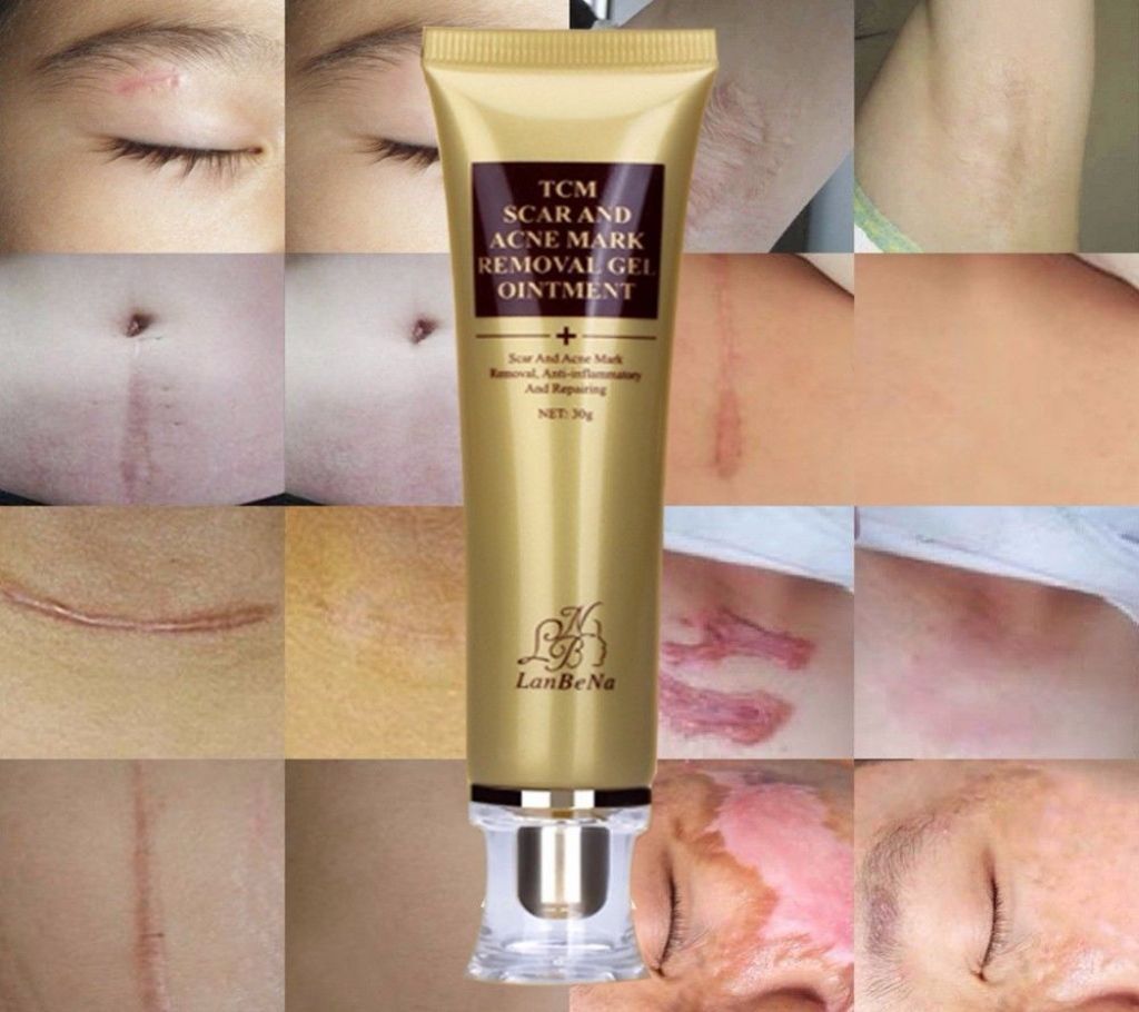 TCM Scar and Acne Mark Removal Gel Requirement (30g)