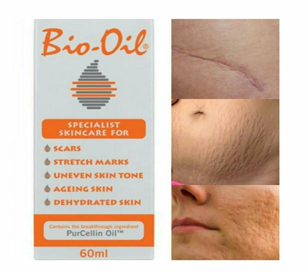 Bio-Oil for Women- Pregnancy Stretch Marks, Dark Elbows, Dark Knees, Dry Hand, Dark Neck, Acne Scars Remover 60ml - South Africa