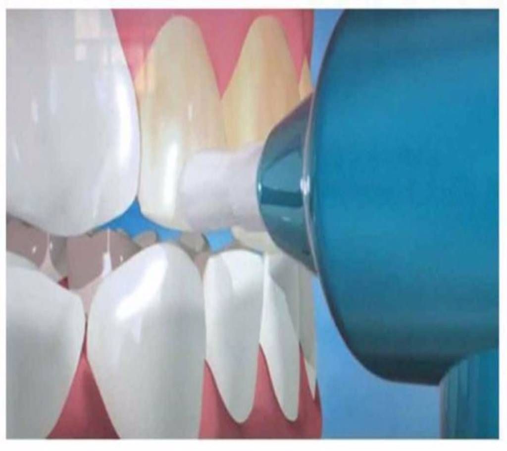 LUMA SMILE TEETH WHITNING KIT
