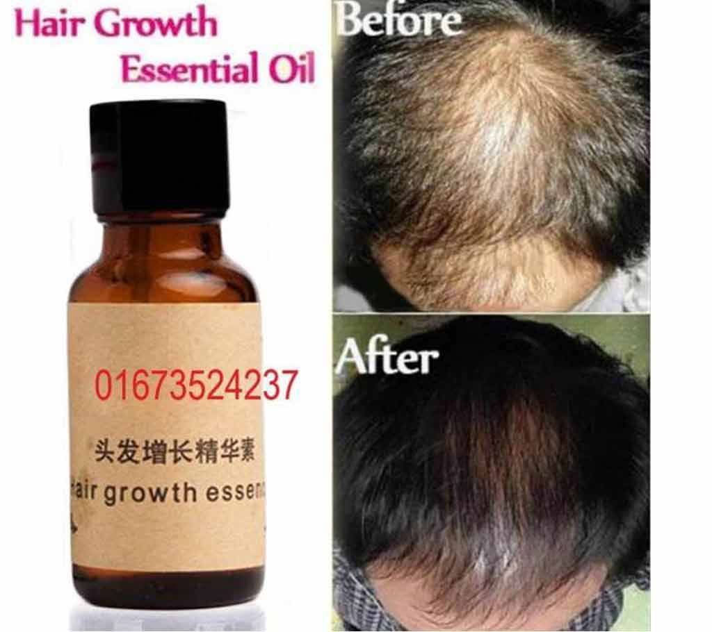 Andrea Hair recovery Scalp Treatment