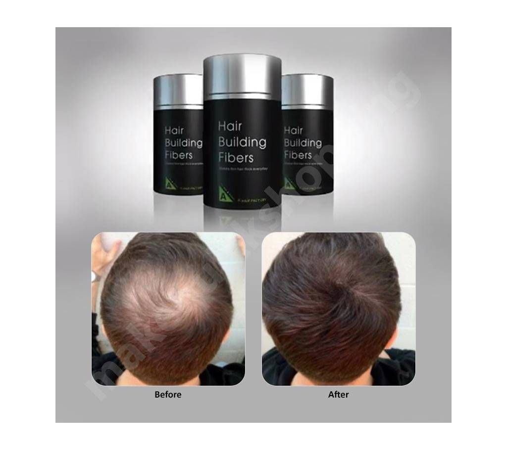Hair Building Fiber For Man And Woman Hair Fall No Issue Caboki Dark Brown