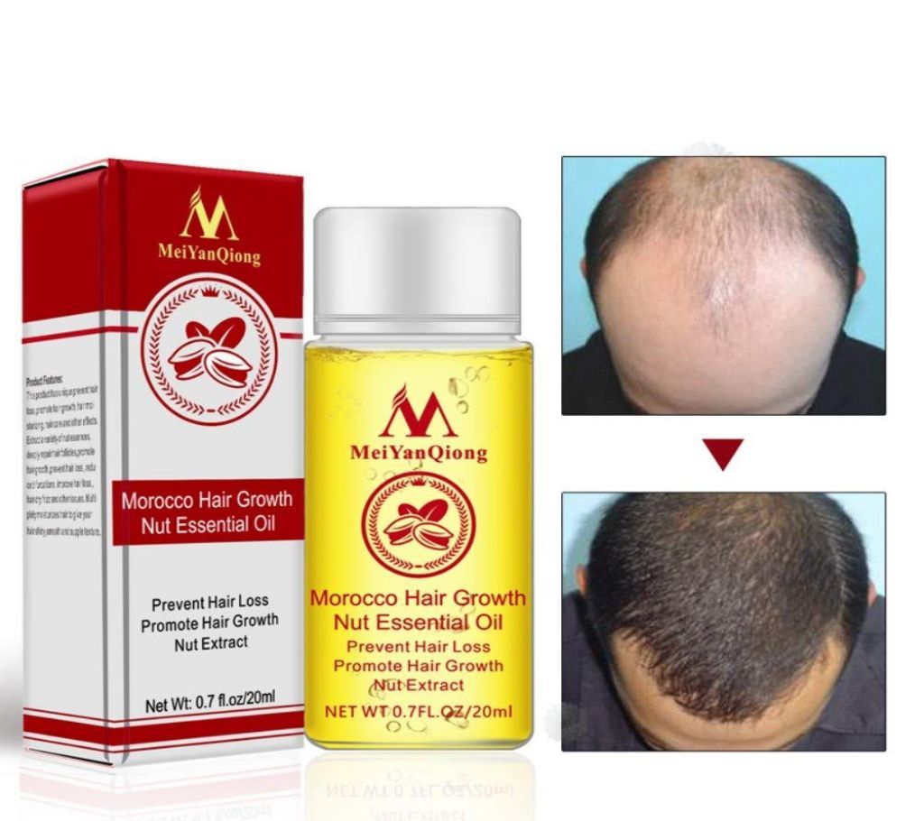 MEIYAN QIONG HAIR GROWTH OIL