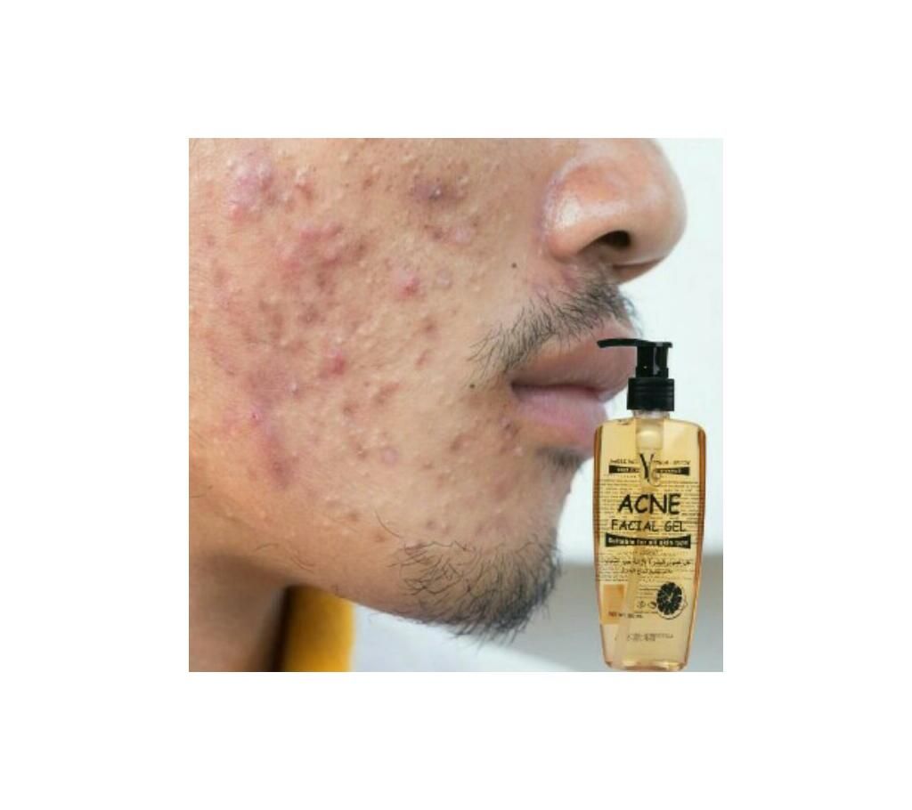 Yc acne facial gel- Thailand