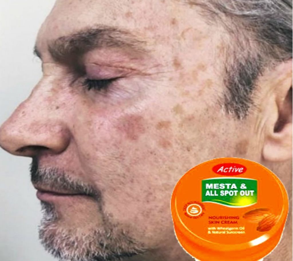 Mesta & All Spot Out Skin Cream - 15 ml (Pakistan)