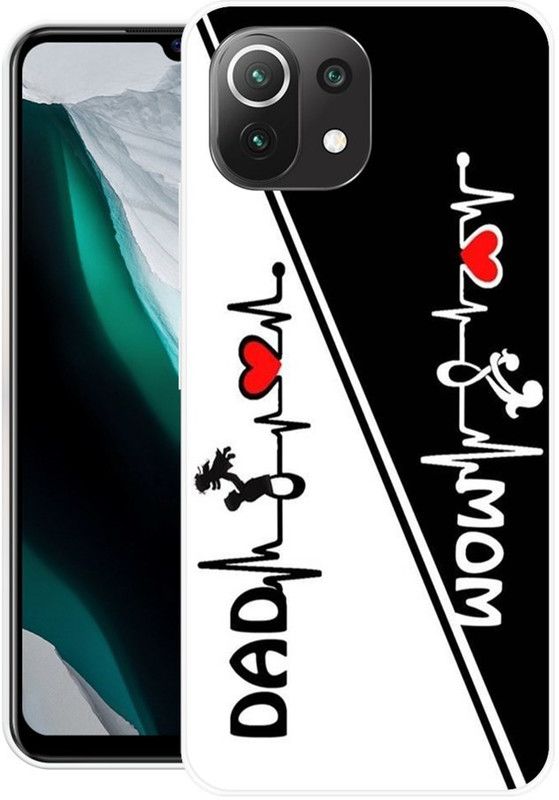 Krtagy Back Cover for Mi 11 Lite 5G  (Black, White, Dual Protection, Silicon)