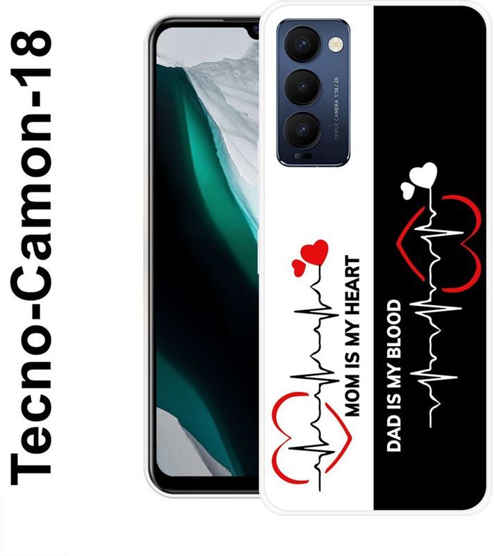 JATLAND Back Cover for Tecno Camon 18  (White, Black, Grip Case, Silicon)
