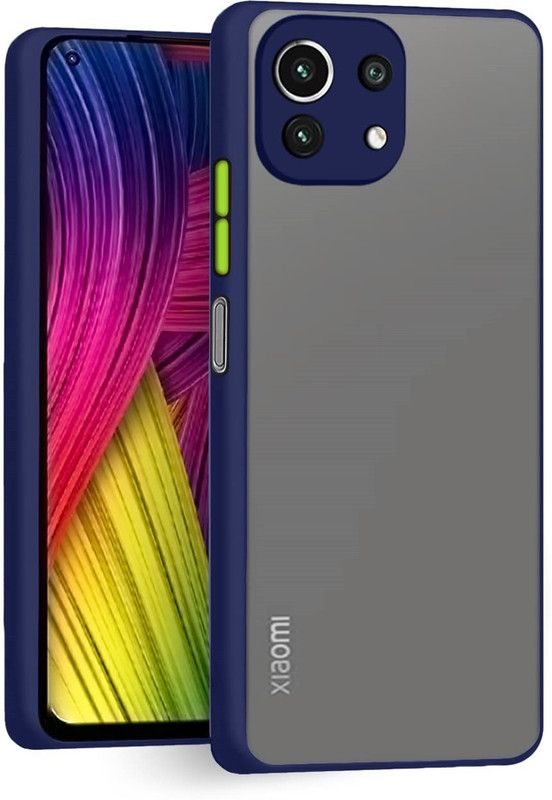 S-Hardline Back Cover for Mi 11 Note  (Blue, Pack of: 1)