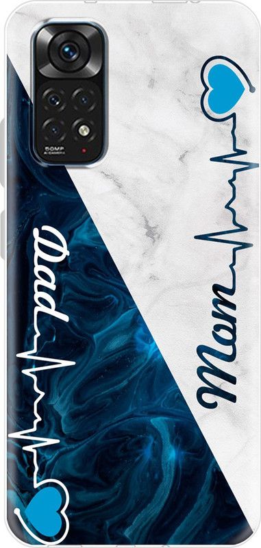 Flipkart SmartBuy Back Cover for Redmi Note 11  (Blue, White, Grip Case, Silicon, Pack of: 1)