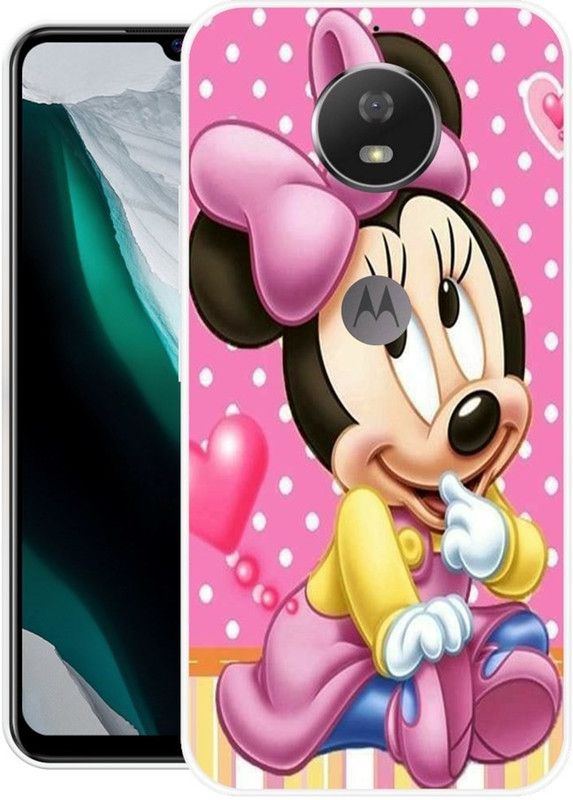 Looy Back Cover for Motorola Moto G5s  (Pink, Flexible, Silicon, Pack of: 1)