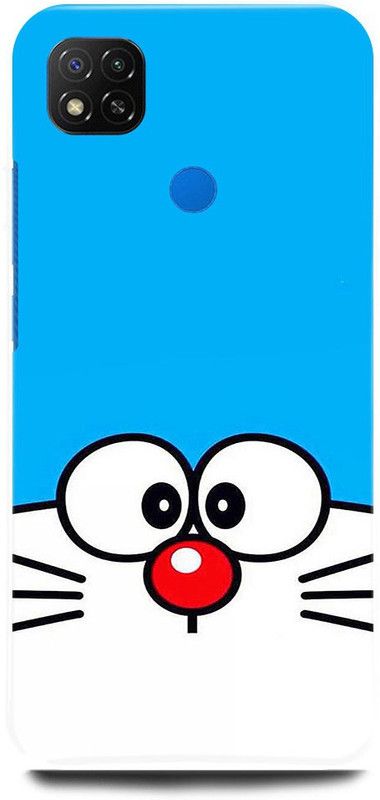FRONK Back Cover for REDMI 9 Activ  (Blue, Hard Case, Pack of: 1)