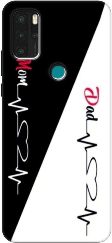 Abuy Back Cover for Micromax Note In 1  (Black, White, Silicon)