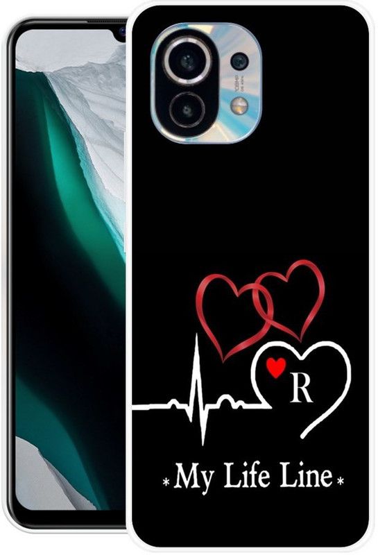 PINKZAP Back Cover for Mi 11 Lite, Mi 11 Lite 5G  (Black, Grip Case, Silicon)