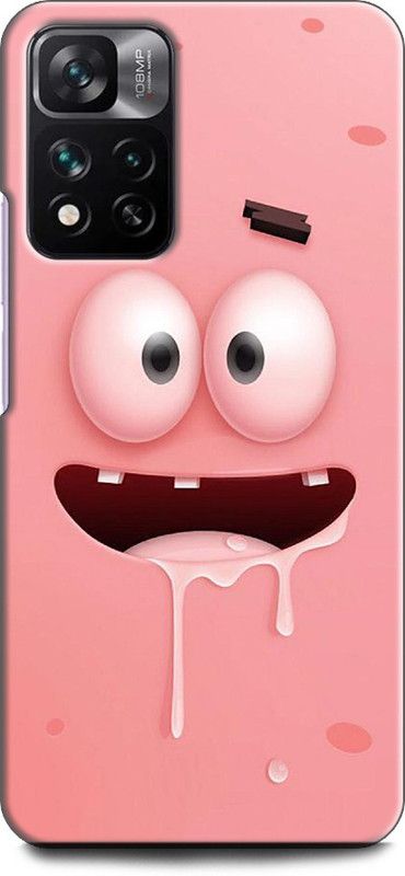 KEYCENT Back Cover for Xiaomi 11i 5G CARTOON, EMOJI, FUNNY, ABSTRACT, SPONGBOB SQUARPANTS  (Multicolor, Shock Proof, Pack of: 1)