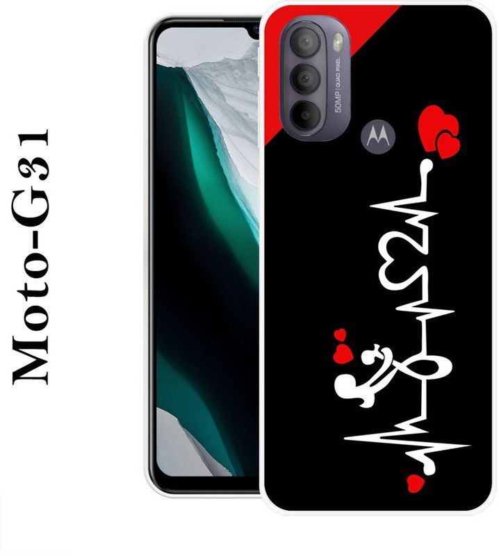 BAGRA Back Cover for Motorola Moto G31  (Black, White, Silicon)