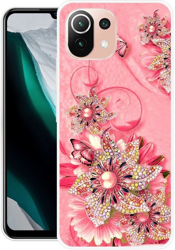 SUPER CASE Back Cover for Xiaomi 11Lite NE  (Multicolor, Grip Case, Silicon, Pack of: 1)