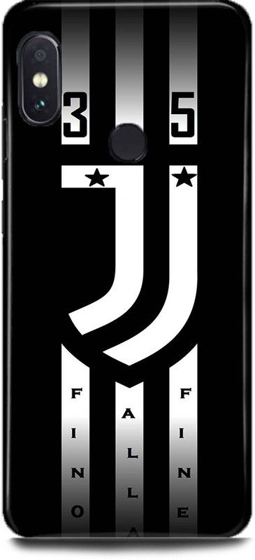 MP ARIES MOBILE COVER Back Cover for Mi Redmi Y2  (Black, White, Hard Case)