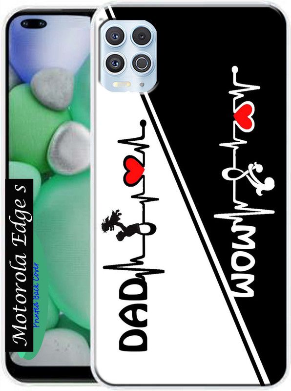 HEXAcase Back Cover for Motorola Edge S  (Black, White, Dual Protection, Silicon, Pack of: 1)