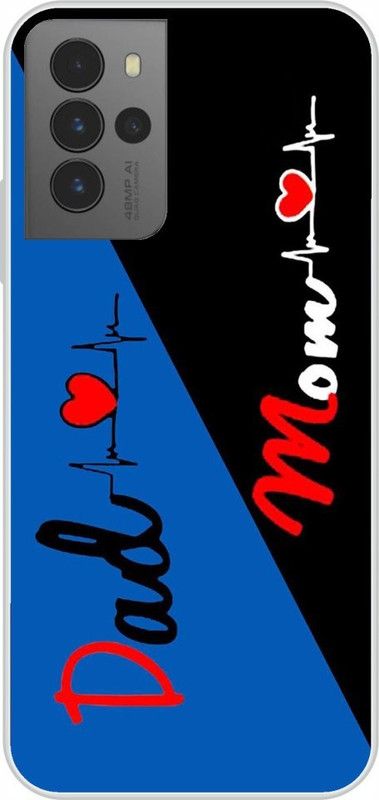 Dreamcase Back Cover for Micromax In Note 2  (Black, Blue, Silicon)