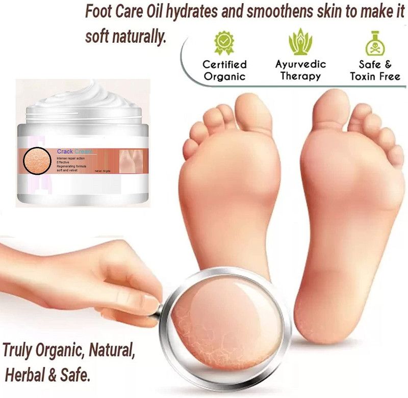 imelda Organic Premium Cracked Heel Repair & Smooth Foot Cream  (50 g)