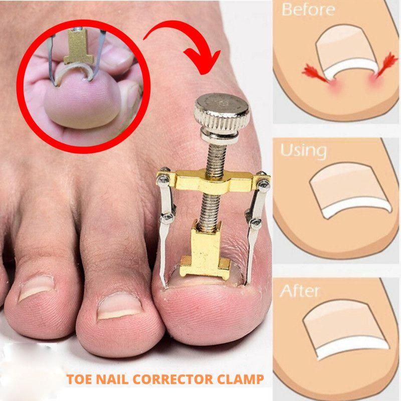 Nail care machine for nail repair