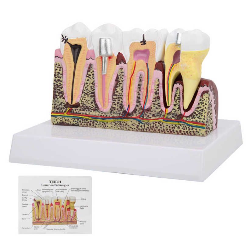 Chenmeng La Dental Teeth Model Oral Cavity Detachable Anatomical Demonstration Base for Education