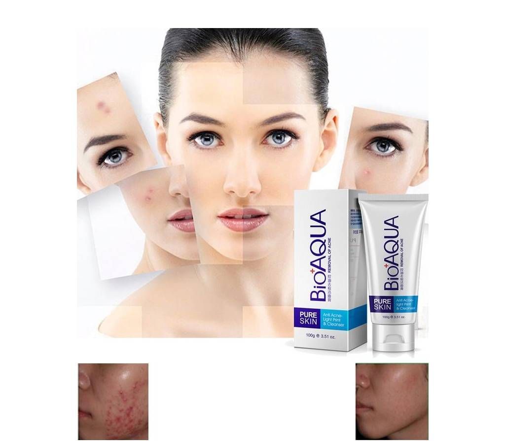 Bioaqua Pure Skin Facial Wash Acne Cleanser  100 gm-China