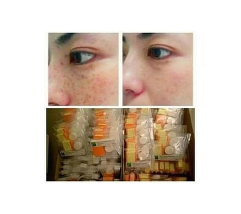 Clobetamil G Cream Day cream and night cream and soap combo (3 in 1 set) - Thailand