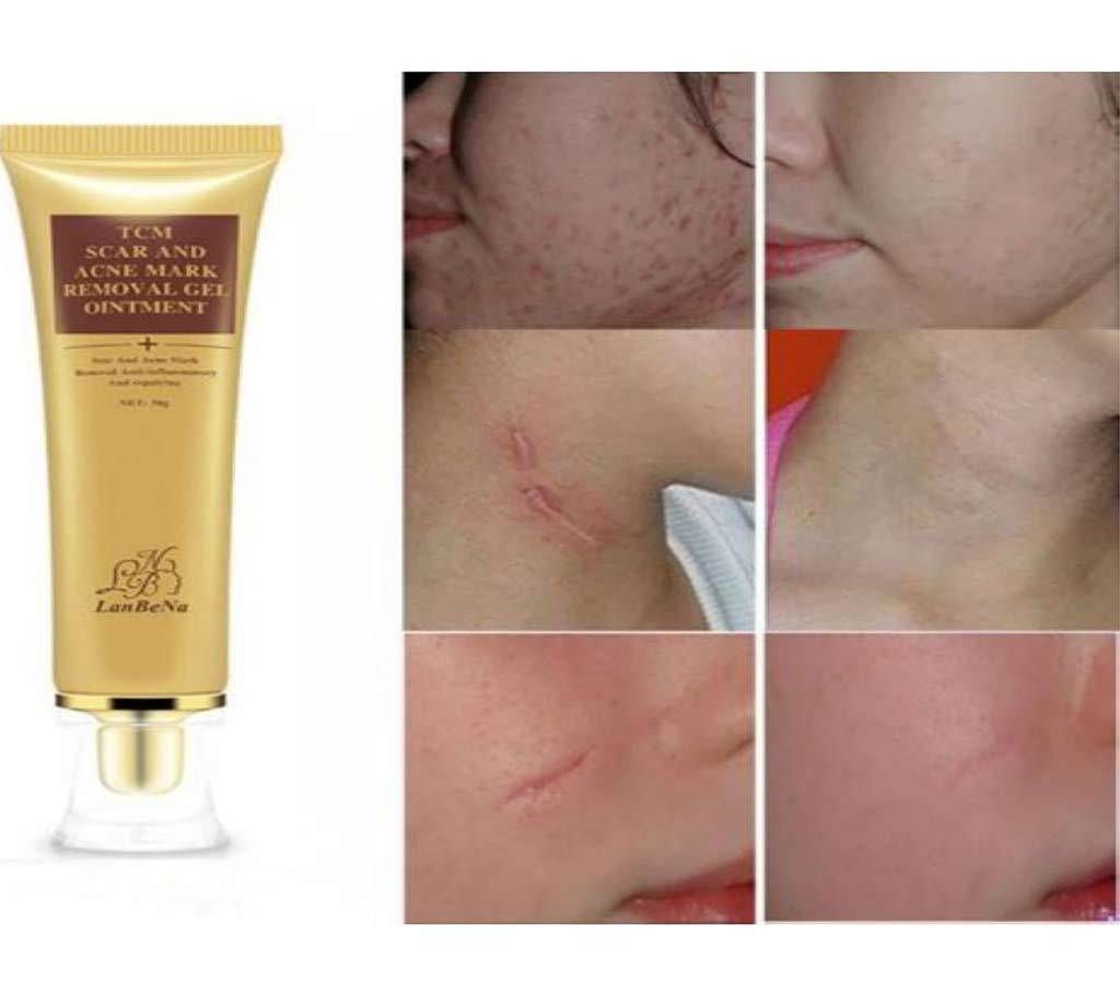 TCM Scar and acne mark removal gel ointment (30g)
