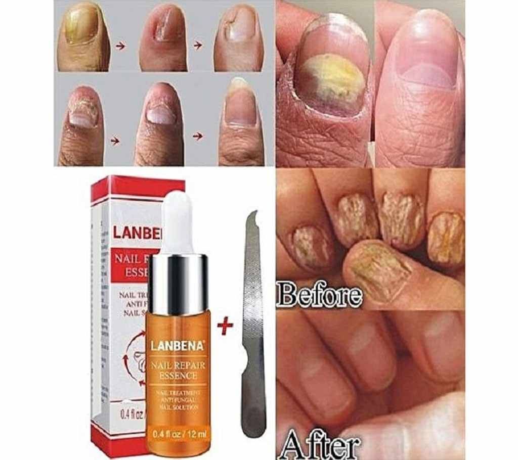 LANBENA Nail Repair Essence Serum 15ml - Korea