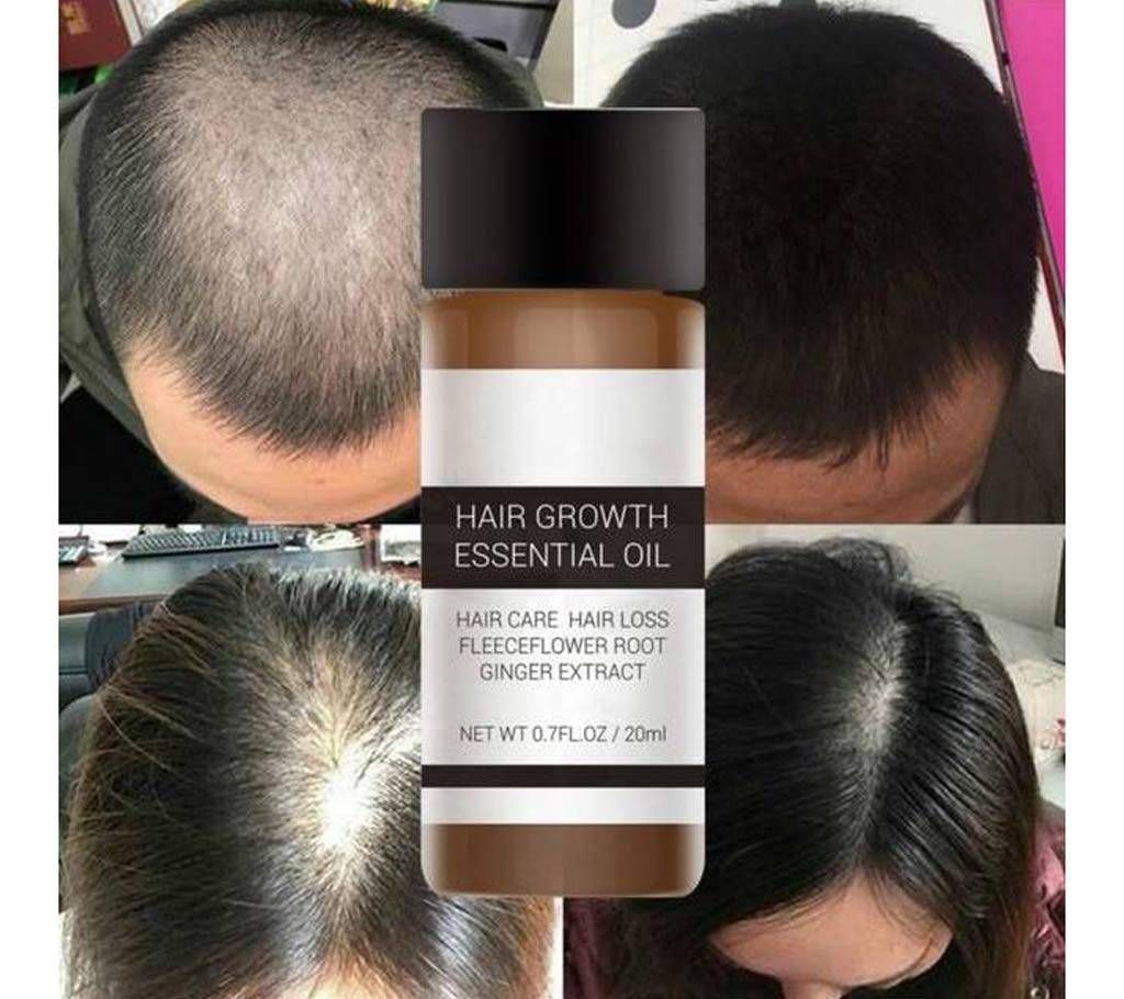 LANBENA Hair Growth Essence oil 20ml China
