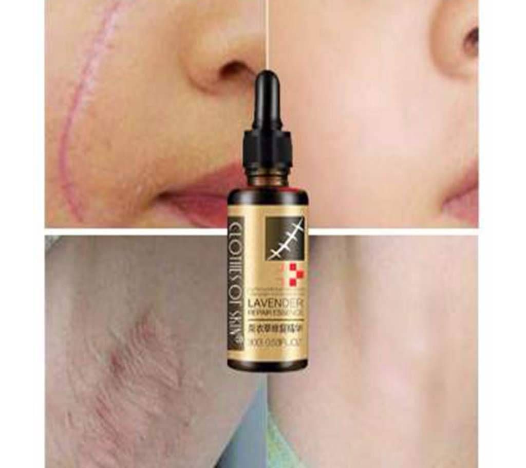 Scar Removal Lavender Oil Essential Massage Oils  For Pregnant Women Hyaluronic Acid Serum 30g China